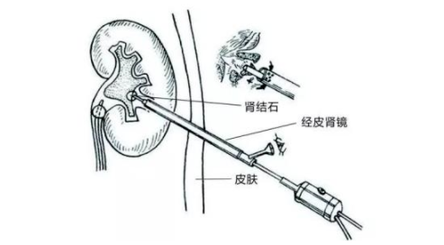 微信截图_20210607083236.png