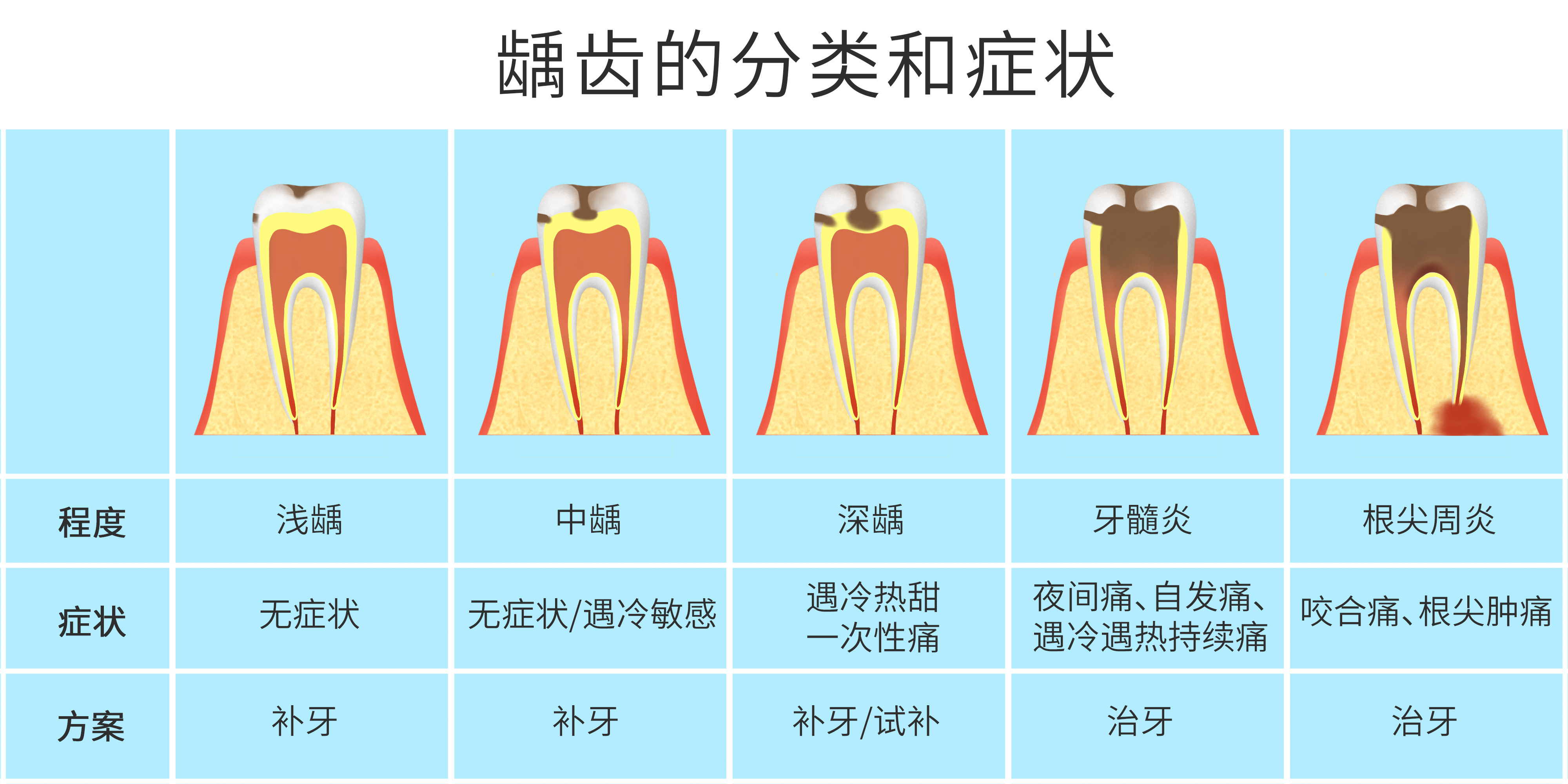 龋齿分类.jpg